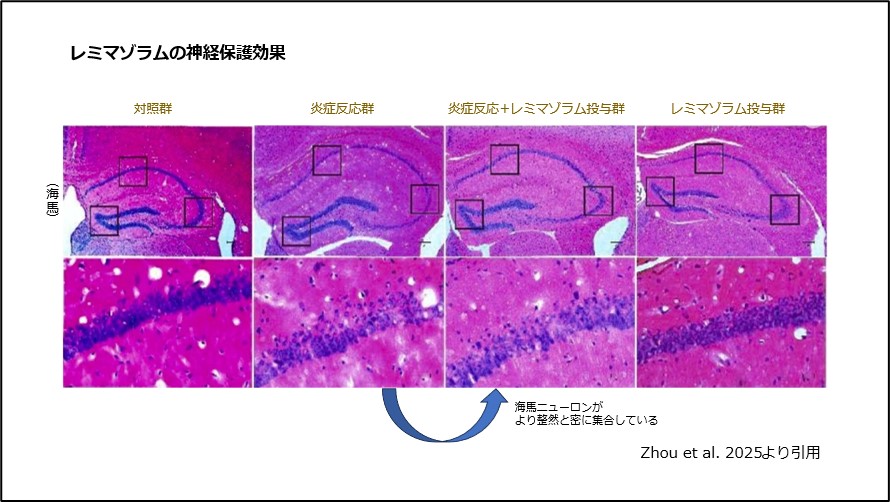 レミマゾラムの神経保護効果