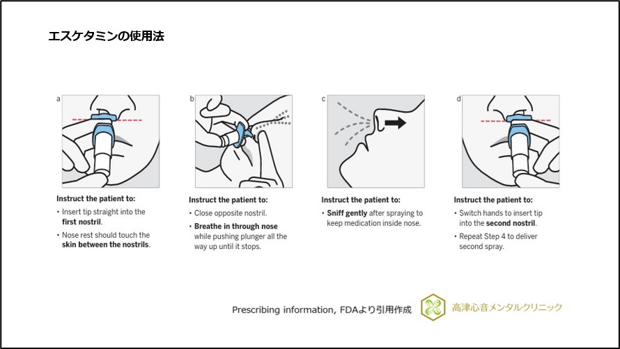 エスケタミンの使用法