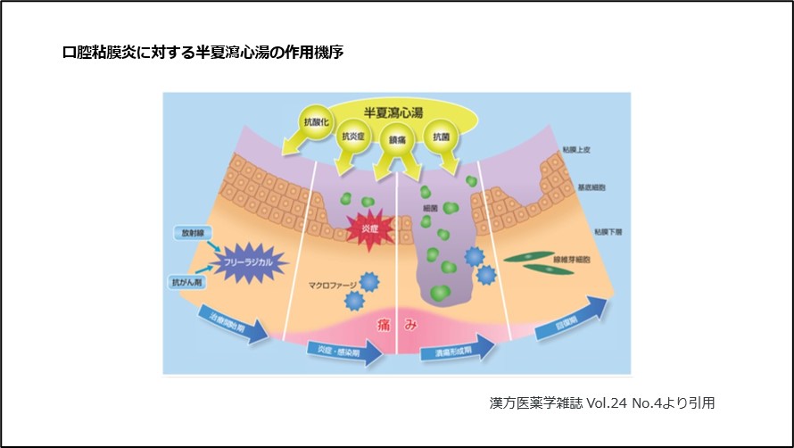 口腔粘膜炎に対する半夏瀉心湯の作用機序