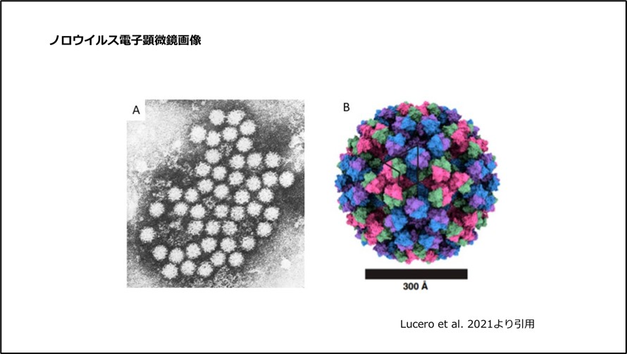 ノロウイルス電子顕微鏡画像
